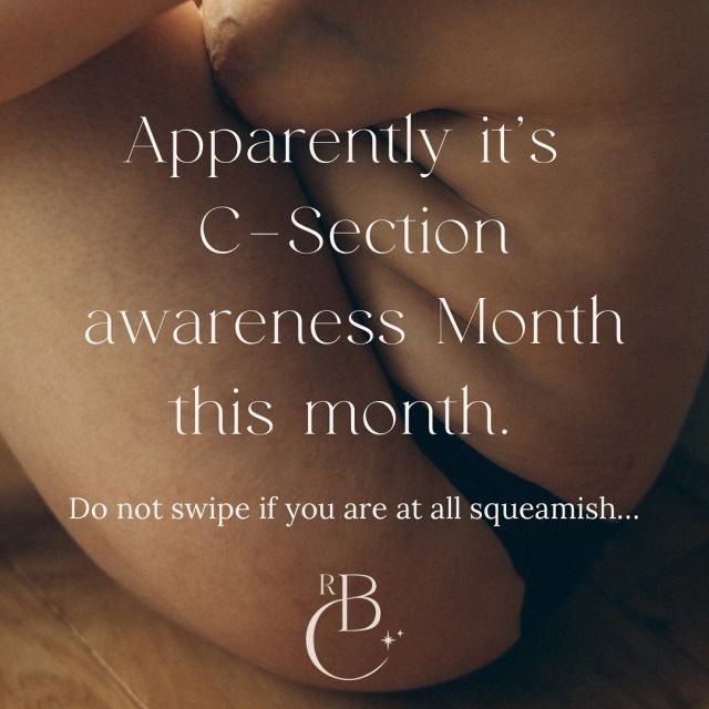 This month is C-Section awareness month, and it got me thinking about my own.

I have birthed two babies, vaginally with one and abdominally with the other. I had one at home and another in a theatre ward; both times resulted in me being in absolute awe of my body and all women’s bodies, for that matter!

My homebirth showed me just how strong I am mentally and physically, and the whole experience was unbelievably empowering, but my C-Section showed me how to heal, how to stop, and how to surrender.

For anyone who thinks a Section is an easy way out, they are very much mistaken. With my vaginal birth, I was hosting a Christmas party the day after and walking downtown two days after that. My section, on the other hand, took weeks to heal from; I’m still healing now. I’d choose a V-birth any day, but god, am I grateful I got to experience both sides of the coin!

My section made me pause and realise that it’s okay to just stop, to appreciate what my body has just done for me, what it continues to do for me. And in return, I was going to give it the time and space to heal. Not too long, though; I had a music festival to be at 10 days later 😂.

My point is, when we stop and think about all the amazing things our body does do for us instead of all things our bodies don’t/can’t do, we can completely change how we see it…when I’m looking at my scar or my stretch marks or getting frustrated at how weak my core is, I try to remember that and I look back at the pictures of me birthing my son, and whisper, “thank you body, I love you”.

 📷 (cover)- @ruemcconnellphotography 
 📷 (c-section)- my utterly squeamish husband 
🎵- Here comes the sun - (the song my baby boy  came out to…very fitting I think)
